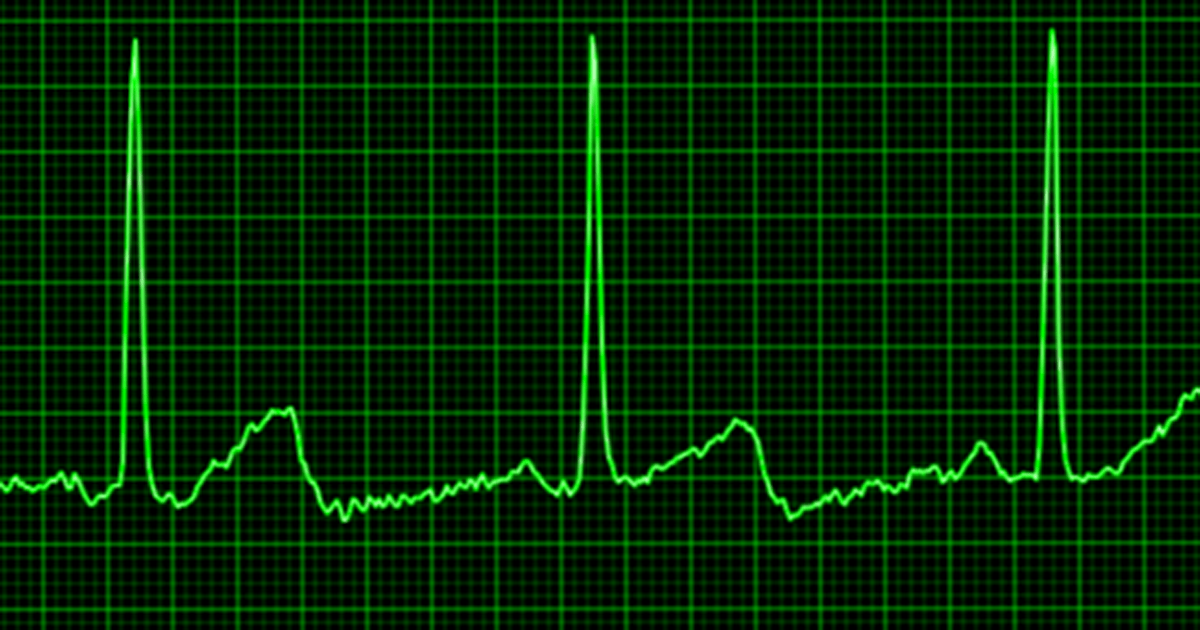 hrv test messung herzratenvariabilität