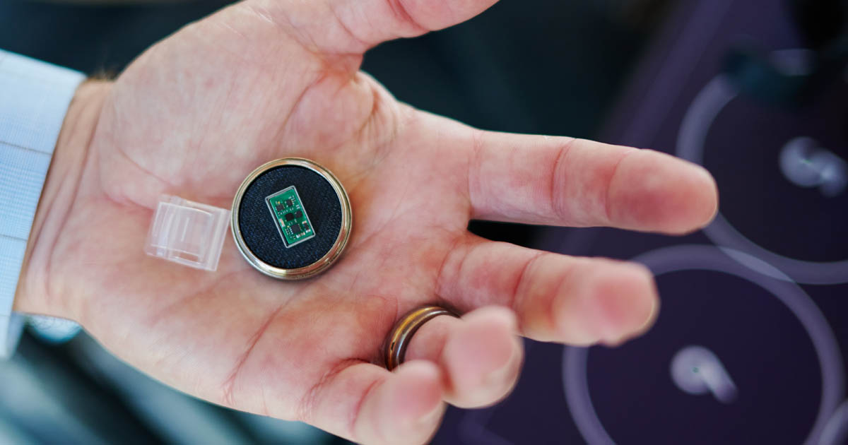 vagusnerv stimulation